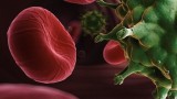 Đã loại bỏ được virus HIV khỏi tế bào người