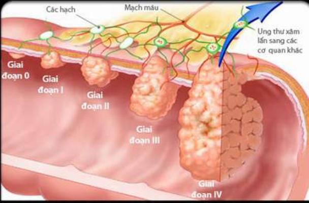 Xây dựng thành công quy trình chẩn đoán và điều trị ung thư da ở Việt Nam