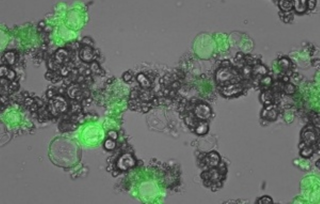 Chế tạo thành công hạt nano silicon dùng trong chữa trị ung thư