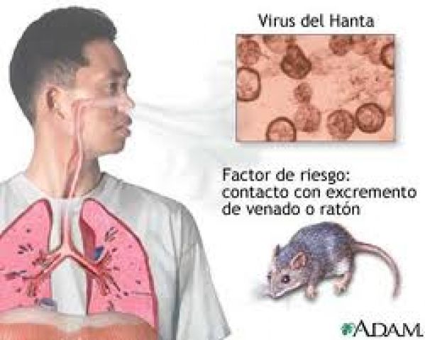 Nguy cơ bị virus Hanta gây suy thận từ chuột cống